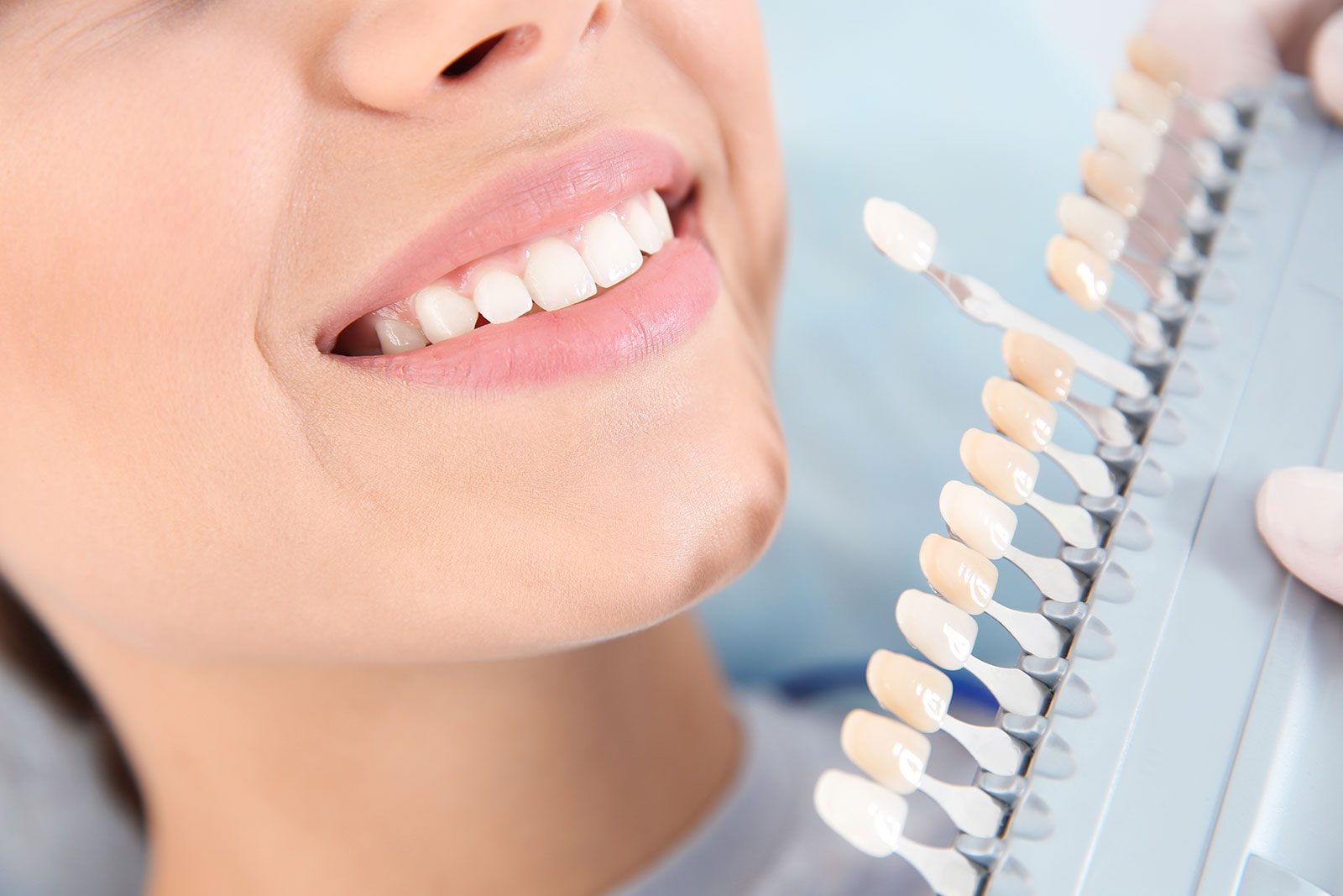 ottawa teeth whitening